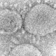 An electron microscopic image of SARS-CoV-2, the virus that causes covid-19
